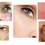 What is your skin type?