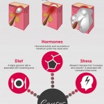 What you Need to Know About Acne?