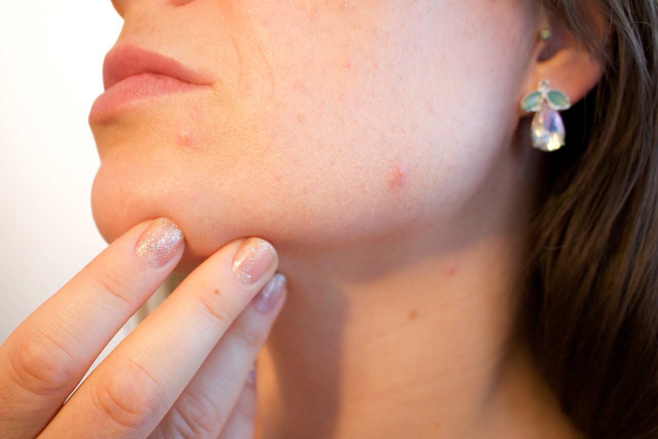 What’s the Finest Skincare Routine for Delicate and Pimples Susceptible Pores and skin?